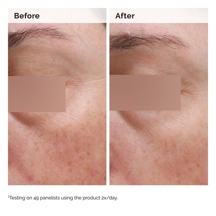 niacinamide-5-face-and-body-emulsion-z8 2024-08-23-ORD-Nia-5pct-Face-Body-B-A-Elasticity-Global-02-1x1.jpg