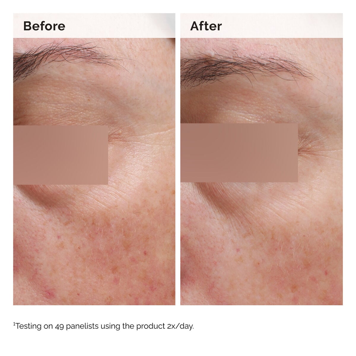 niacinamide-5-face-and-body-emulsion-z8 2024-08-23-ORD-Nia-5pct-Face-Body-B-A-Elasticity-Global-02-1x1.jpg