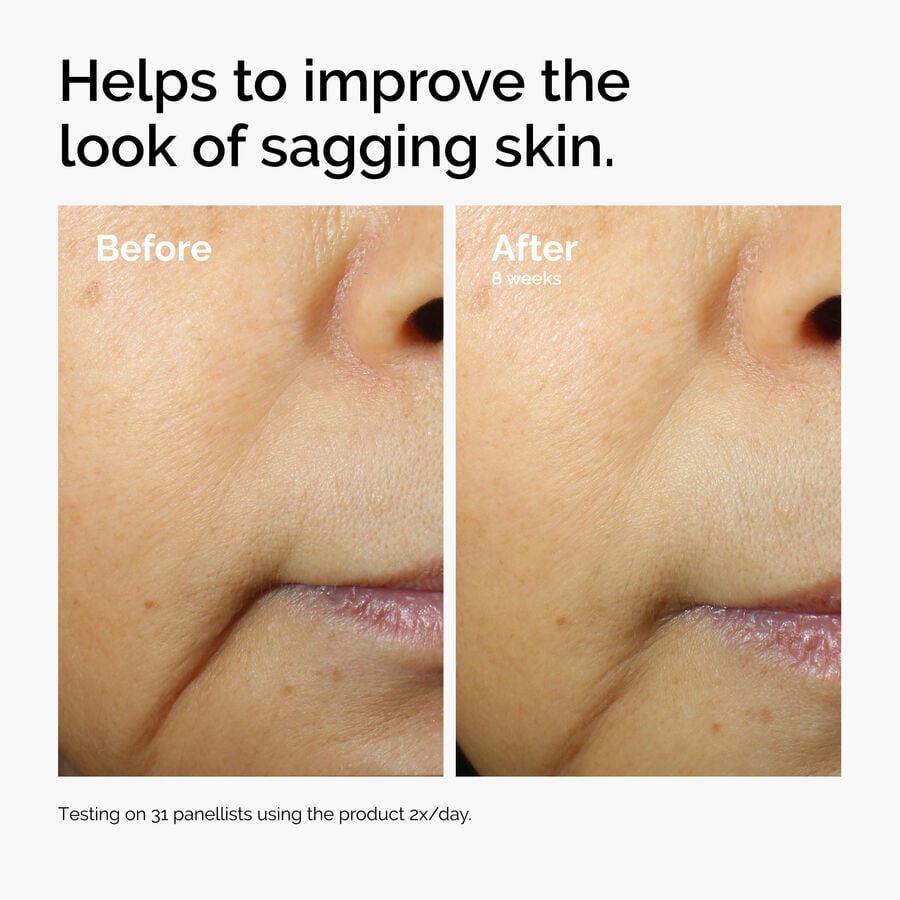 caffeine-3-escin-1-face-serum-a2 ord-caffeine-3pct-escin-1pct-face-serum-before-after-sagging.jpg