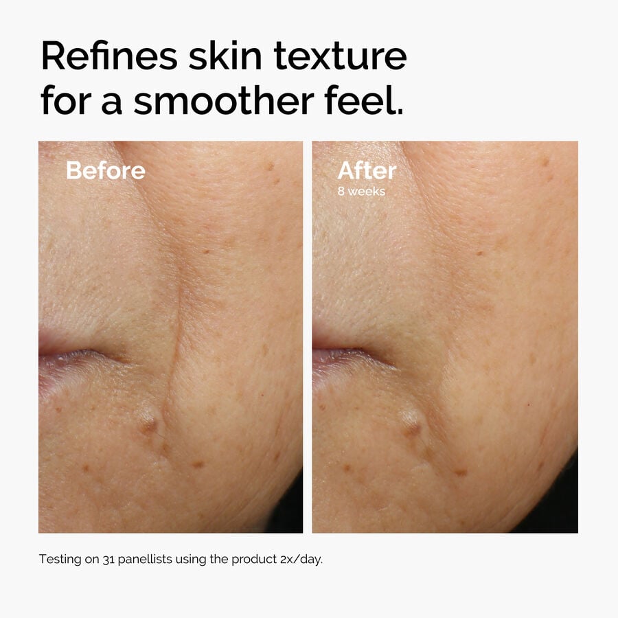 caffeine-3-escin-1-face-serum-a2 ord-caffeine-3pct-escin-1pct-face-serum-before-after-texture.jpg