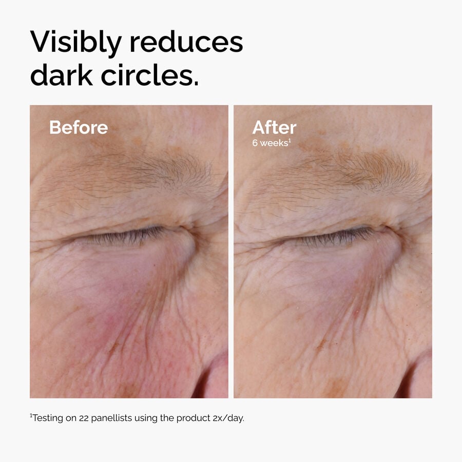 caffeine-solution-5-egcg-eye-serum-i5 ord-caffeine-solution-egcg-dark-circles-before-after.jpg