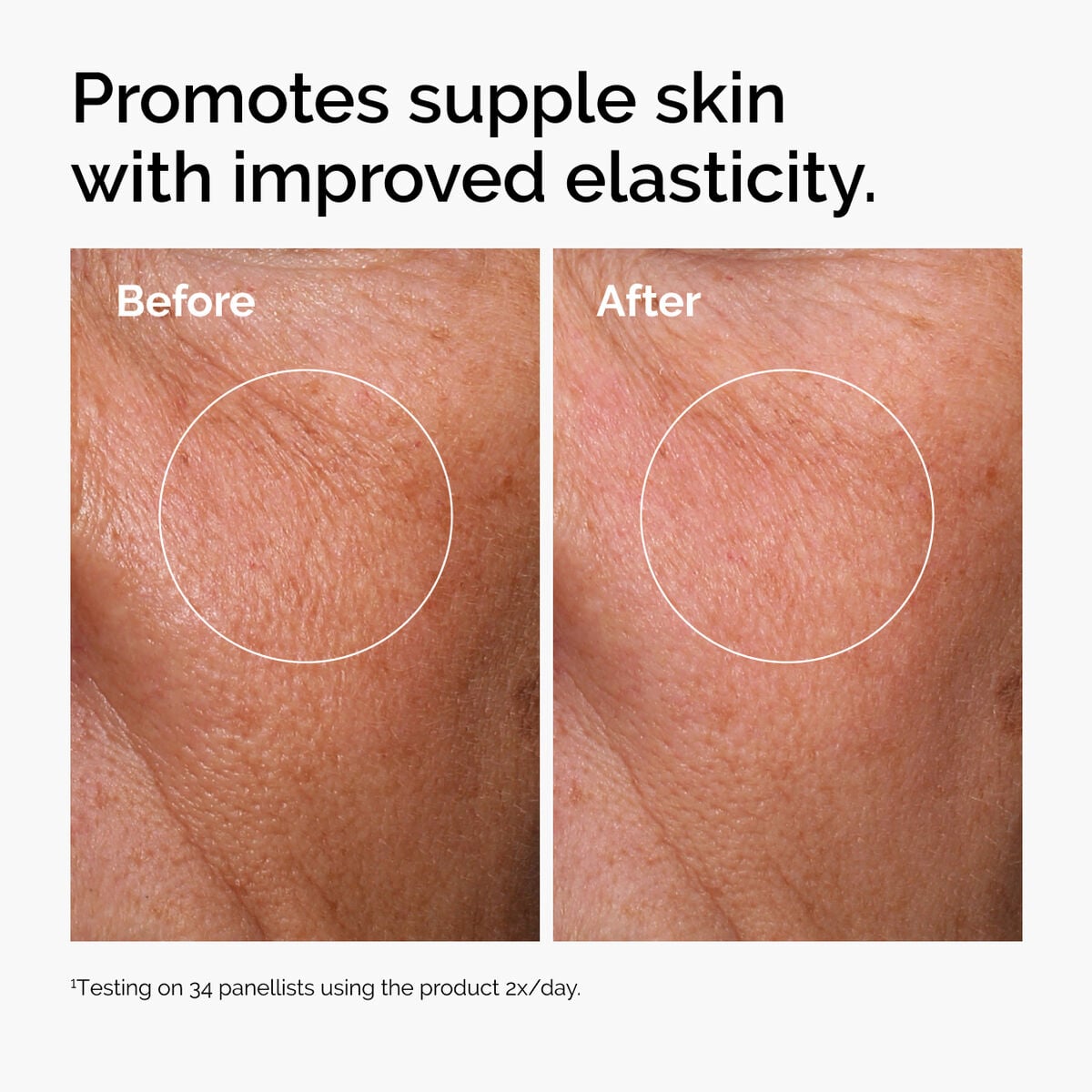 hyaluronic-acid-2-b5-with-ceramides-i1 ord-hyaluronic-acid-2pct-b5-hydrating-serum-before-after-elasticity.jpg