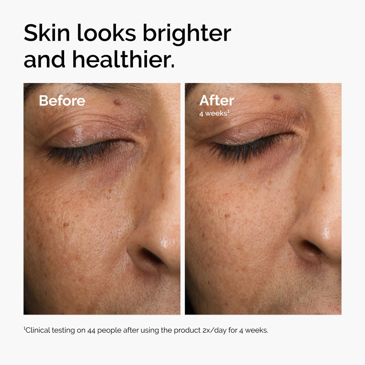 multi-antioxidant-radiance-serum-n4 ord-mars-before-after-healthy.jpg