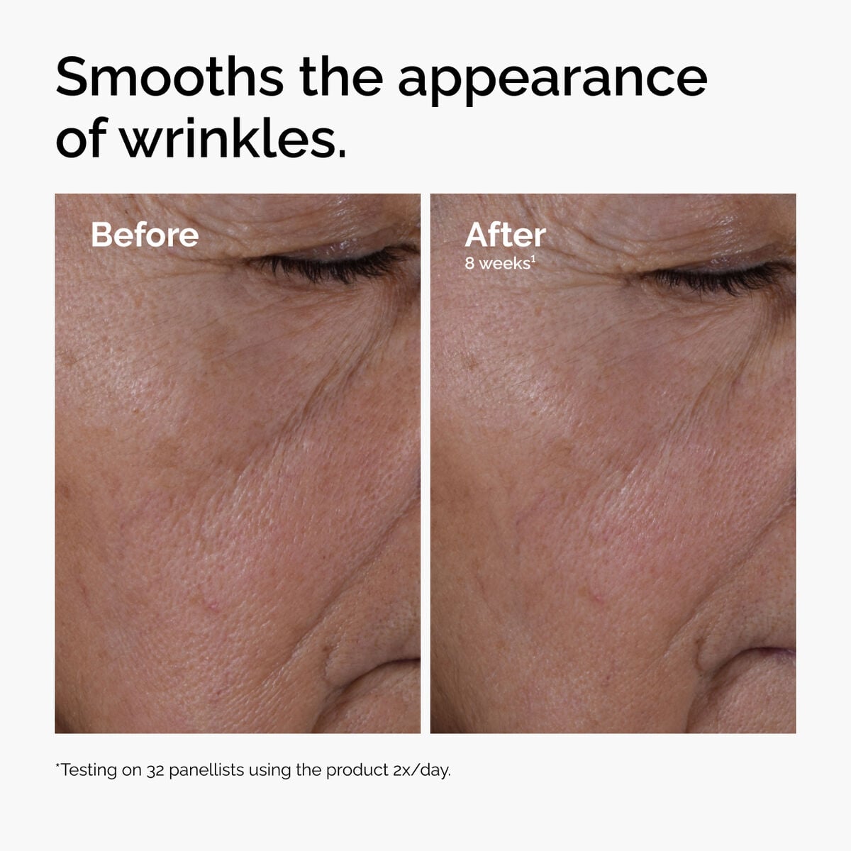 multi-peptide-ha-serum-l8 ord-multi-peptide-ha-serum-wrinkles-before-after.jpg