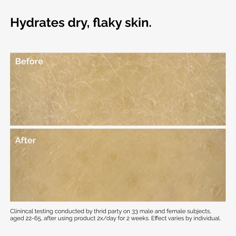 the-body-care-collection-p2 ord-natural-moisturizing-factors-inulin-body-before-after-graphic-02.jpg
