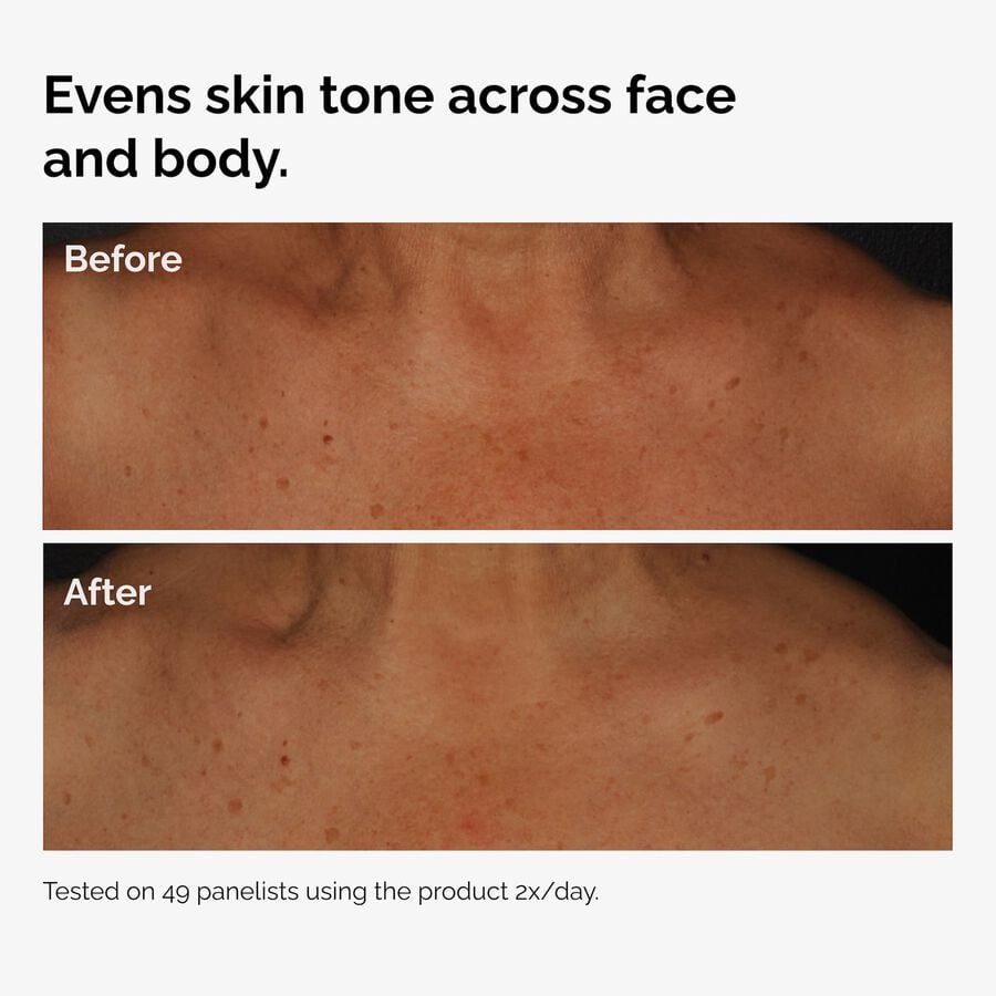 the-body-care-collection-p2 ord-niacinamide-face-body-serum-before-after-even-tone-graphic.jpg